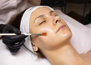 Chemical Peels Treatment by The Secret Plump in Freehold, NJ